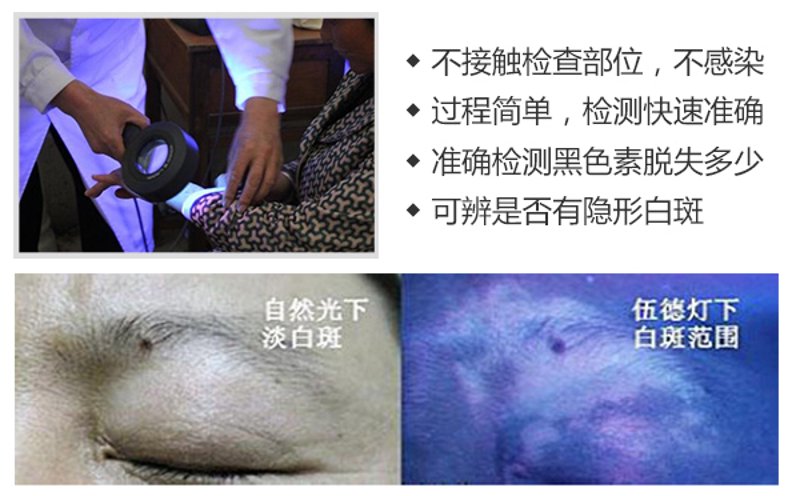 医保定点白癜风医院:开启希望之门